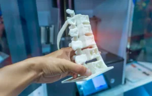 Medical Device Industry 3d printing
